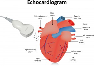 Echocardiogram